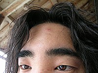 眉間のところが腫れています